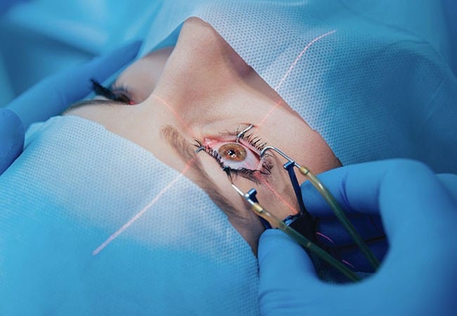 Laser eye surgery procedure in operating room